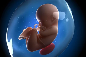 Phát hiện 'con' nằm trong bụng mẹ 36 năm