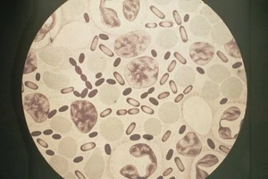 Sốc: vi khuẩn gây chết người 'núp' trong phòng thí nghiệm hàng trăm năm