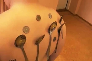 Cậu bé 'nam châm' 12 tuổi hút dính kim loại 