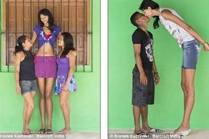 Chênh lệch giàu nghèo khiến chênh lệch chiều cao