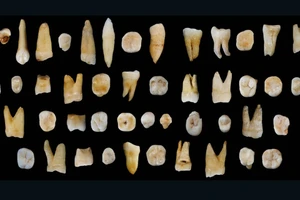 Phát hiện 47 chiếc răng 80.000 năm tại Trung Quốc