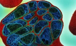 Nguyên nhân phát triển bệnh sốt rét đã được phát hiện