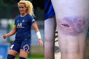 Cầu thủ của PSG bị tấn công kinh hoàng và nghi án 'dan dan díu díu mập mờ'