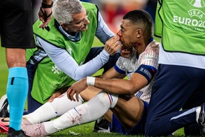 Sốc: Mbappe bị gãy mũi phải lên bàn mổ, nghỉ ít nhất 10 ngày hoặc mất Euro