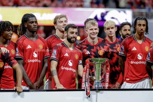 Vết xước trên chiếc cúp vô địch của CLB Manchester United