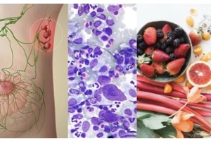 Chế độ ăn uống có thể làm giảm nguy cơ ung thư