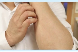 Lời khuyên về chế độ ăn uống khi da bị khô và ngứa theo mùa