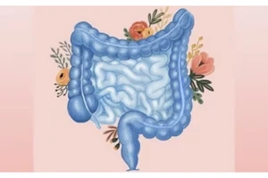 6 loại thực phẩm thay thế lành mạnh để hỗ trợ sức khỏe đường ruột