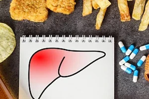 5 loại thực phẩm bạn cần tích trữ để giúp đảo ngược tình trạng gan nhiễm mỡ