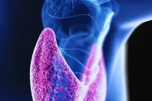 5 chất dinh dưỡng quan trọng cho sức khỏe tuyến giáp