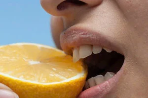 Top loại thực phẩm tốt nhất và tệ nhất cho răng 