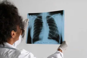 6 thói quen có thể gây hại cho chức năng phổi của bạn ngay cả khi không hút thuốc