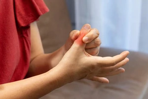 5 cách giảm nồng độ axit uric tự nhiên và ngăn ngừa đau khớp hiệu quả