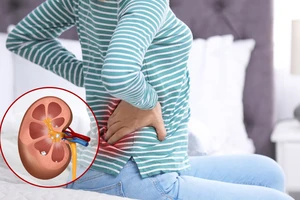 6 mẹo ăn uống bảo vệ thận cho người bệnh tiểu đường