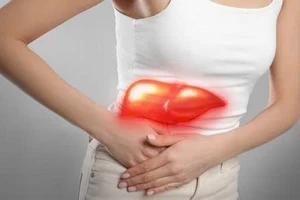 5 thói quen ngăn ngừa gan nhiễm mỡ và bảo vệ gan khỏe mạnh