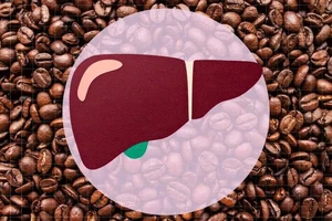 Uống cà phê có tốt cho gan không?