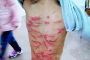 Không làm bài tập, bé 6 tuổi bị mẹ đánh đập tàn bạo