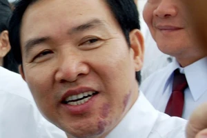 Đối diện án tử, Dương Chí Dũng vẫn “si tình”