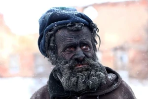 Kỳ lạ: người đàn ông bẩn nhất châu Âu và...đống tro nóng