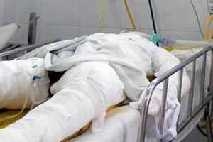 Đốt em gái của người yêu... vì ghen