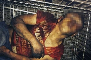 Cậu bé bị đánh đập dã man khiến cả nước Pháp choáng váng