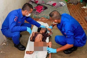 Bé trai gầy trơ xương và biến dạng chân tay vì bị mẹ bỏ đói suốt thời gian dài