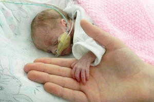 Sức sống kỳ diệu của em bé chào đời chỉ nặng 700 gam