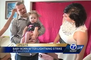 Bé gái có mái tóc dựng đứng do mẹ bị sét đánh lúc mang thai