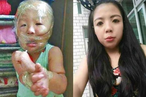 Cô giáo mầm non dán mặt, trói tay bé trai bằng băng dính rồi chụp ảnh đưa lên mạng