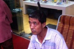 Người đàn ông bị con dao "từ trên trời rơi xuống" cắm thẳng vào đầu
