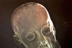 Lạ: Phát hiện răng người thật "mọc" trong miệng tượng Chúa Giêsu 300 tuổi