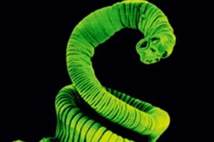 Mẹ cho con ăn... trứng sán để thi hoa hậu