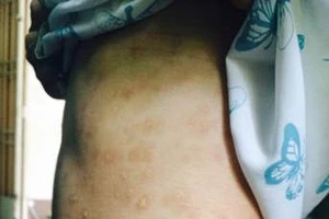 Thiếu nữ 17 tuổi tố bị cha mẹ nuôi bạo hành, cưỡng bức