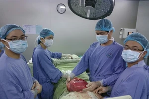 Loại bỏ khối u ‘khổng lồ’ nặng 6,5 kg