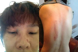 Chồng Dương Yến Ngọc phủ nhận đánh vợ