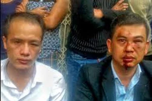 Khởi tố 7 bị can hành hung luật sư vì ‘bị bắn bụi bẩn’