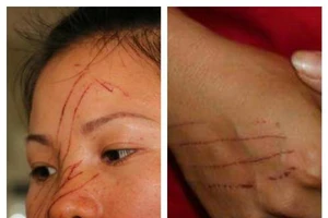 Hai mẹ con bị hàng xóm rạch mặt dã man