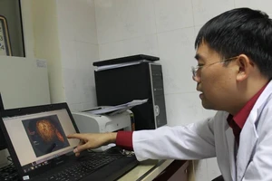 Suýt mất mạng vì ăn hồng ngâm