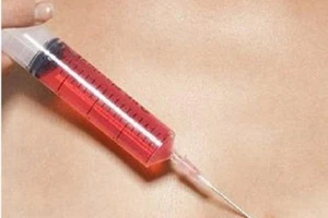 Sẽ áp giải nữ giám đốc thuê người truyền HIV đến tòa