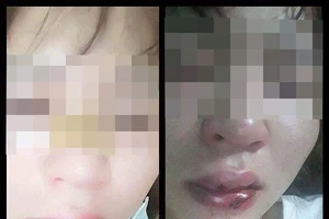 Cô gái giúp đỡ người lạ rồi bị đánh nói gì?