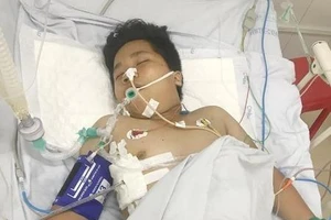 Tìm người thân cho bệnh nhân rách khí quản