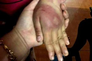 Bố đánh con gái 8 tuổi dã man rồi bỏ trốn