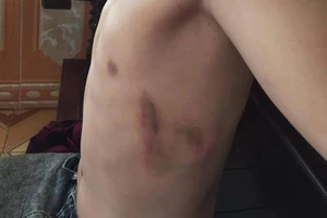 Học sinh lớp 7 bị một phụ huynh đánh ngay trong trường