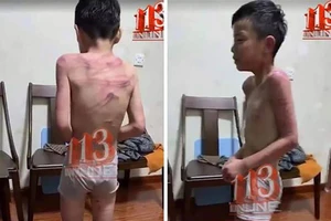 'Bé trai bị bố dượng đánh': Công an 36 xã thị trấn xác minh