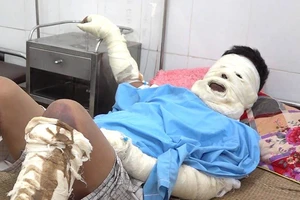 Nổ bình ga trong đám tang, 5 người nhập viện 