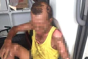 Con trai tưới xăng lên người mình và bố rồi châm lửa 