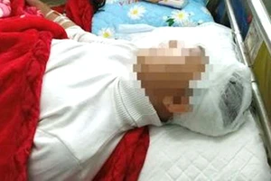 Nam sinh Phan Thanh L. đang được điều trị tích cực tại Bệnh viện Đa khoa tỉnh Thanh Hóa. Ảnh: BV 