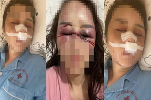 Thông tin mới về vụ 1 cán bộ QLTT ở Thanh Hóa bị tố hành hung phụ nữ 