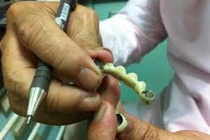 Sặc nước, trôi nguyên hàm răng giả vào cổ họng