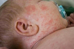 Cơ quan Vũ trụ Anh hỗ trợ Việt Nam 6 triệu bảng